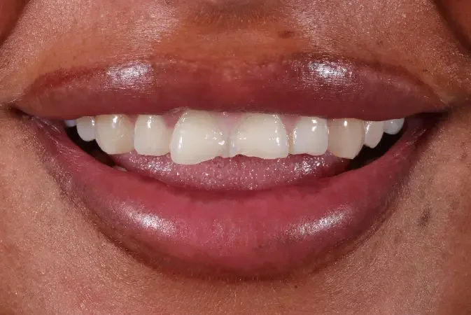 Before