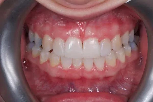 Specialist orthodontics after treatment