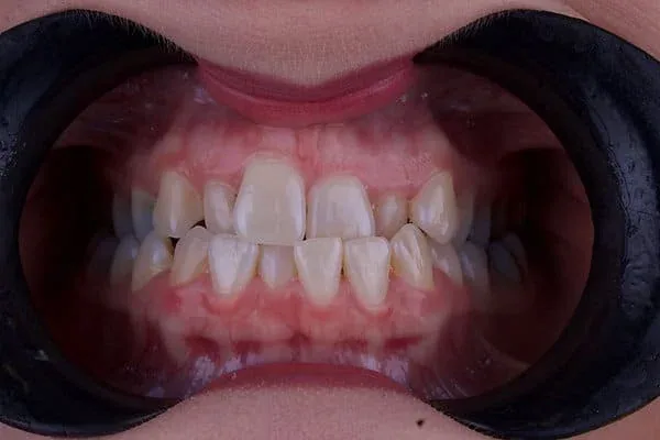 Specialist orthodontics before treatment