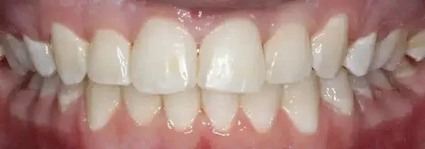 Specialist orthodontics after treatment