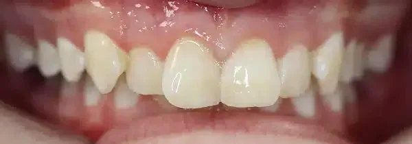 Specialist orthodontics before treatment