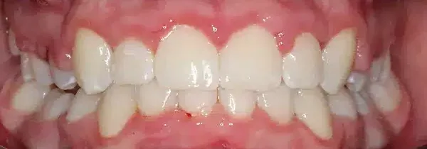 Specialist orthodontics after treatment