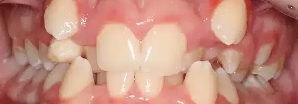 Specialist orthodontics before treatment