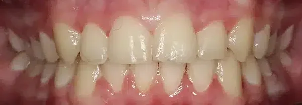 Specialist orthodontics after treatment