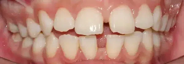 Specialist orthodontics before treatment