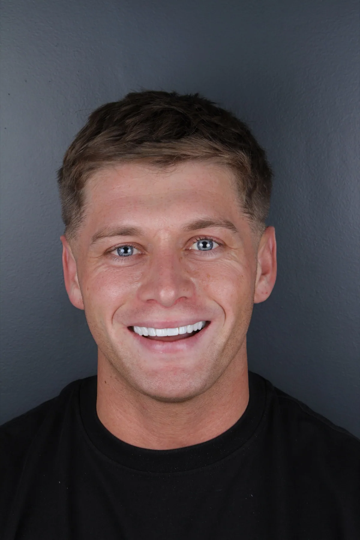 Close-up smile transformation portrait