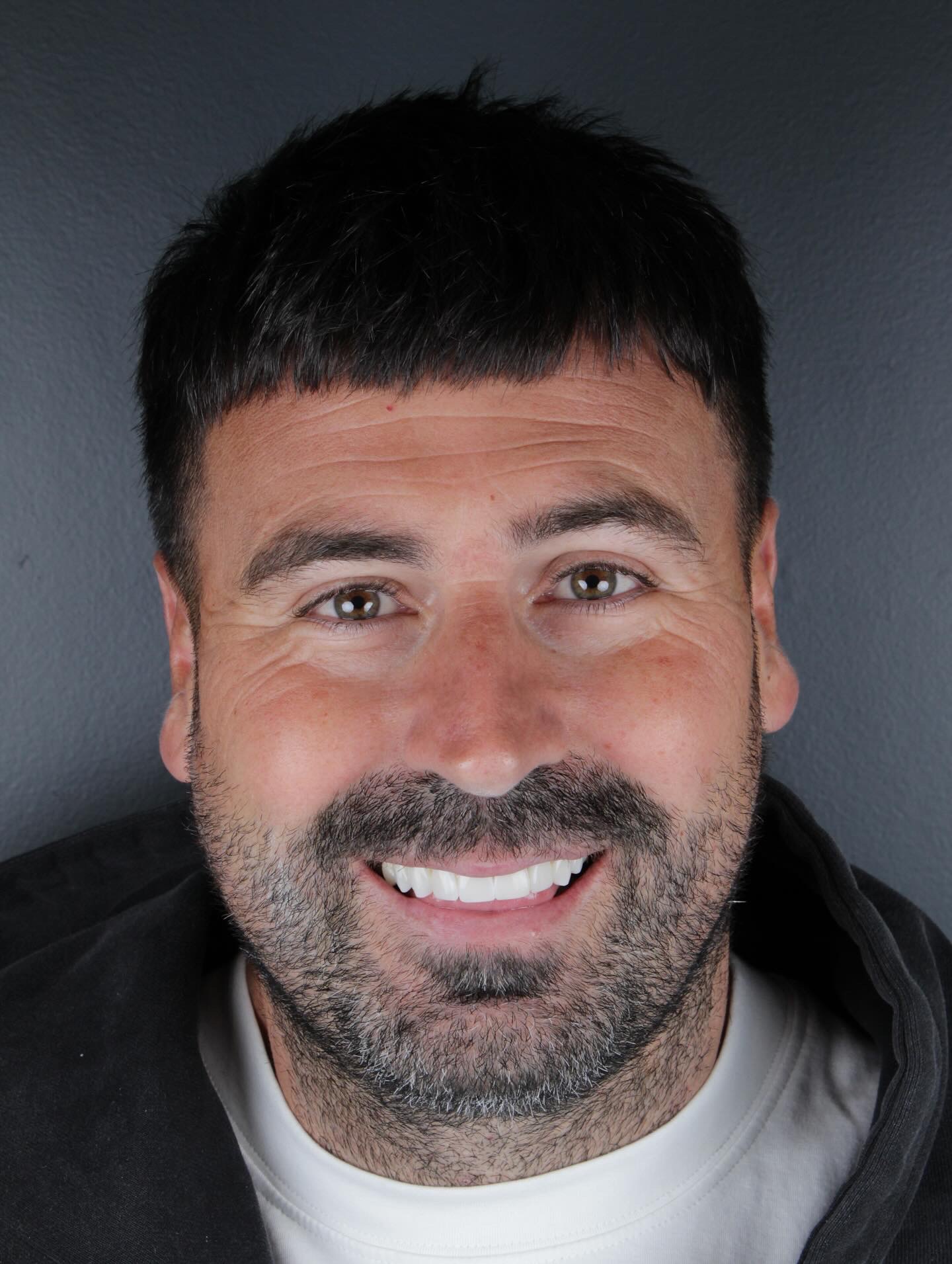 Implant patient smiling after treatment