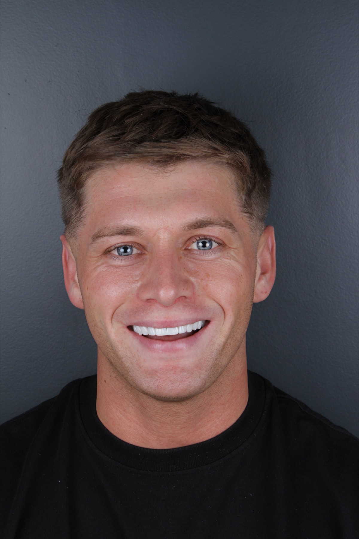 Close-up smile transformation portrait