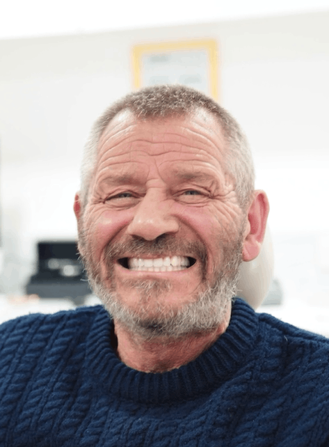 Implant patient smiling after treatment