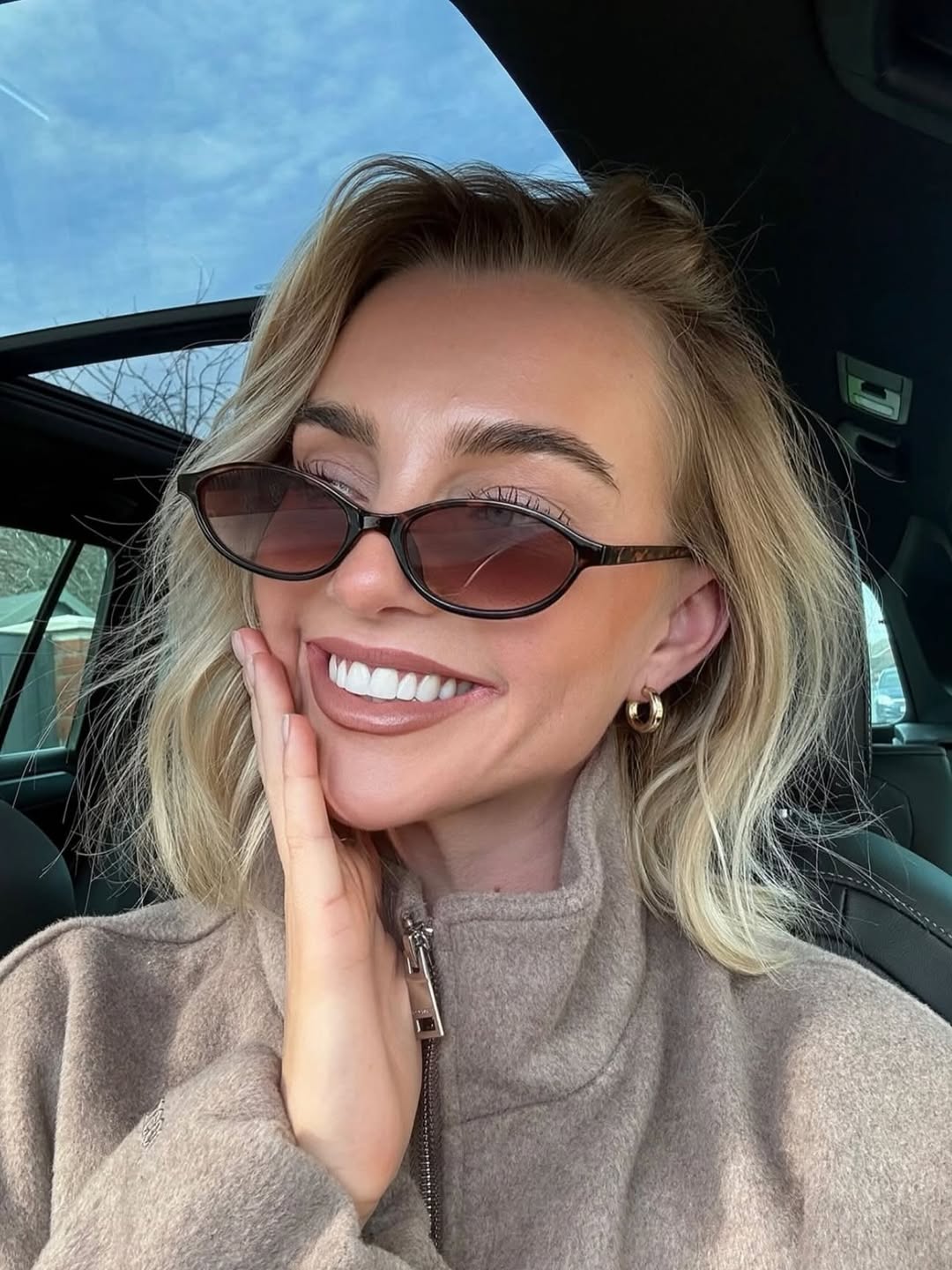 Composite bonding patient smiling after treatment